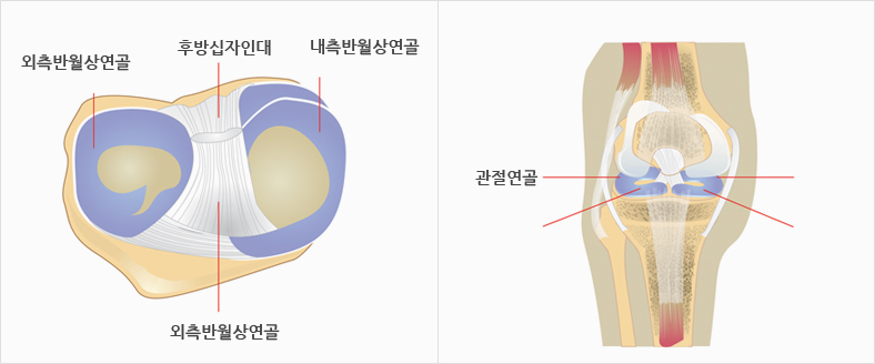 외측반원상연골, 후방십자인대, 내측반월상연골, 관절연골의 이미지